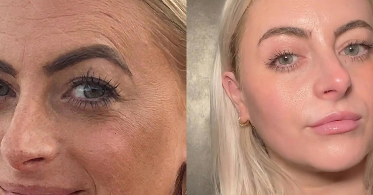 Collagen 5X — Now in Gummy Form