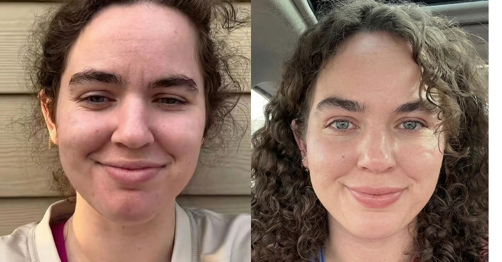 Collagen 5X — Now in Gummy Form